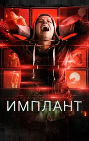 Имплант